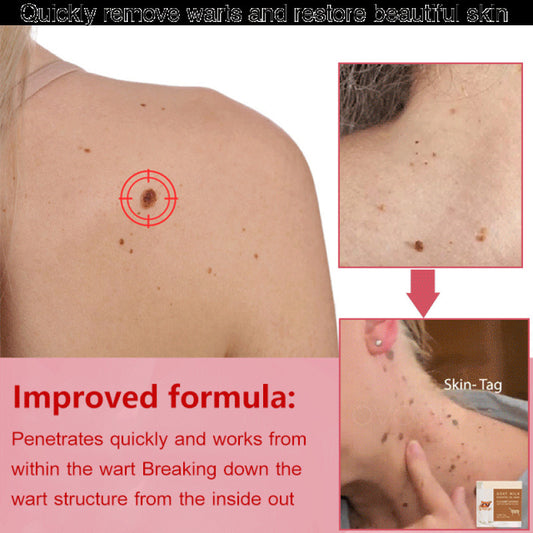 SwipeCart™ Goat's Milk Wart Removing Essential Oil Moisturizing Soap