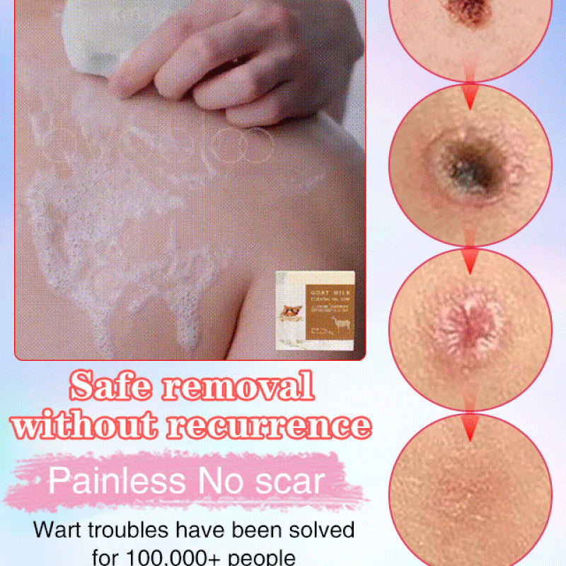 SwipeCart™ Goat's Milk Wart Removing Essential Oil Moisturizing Soap