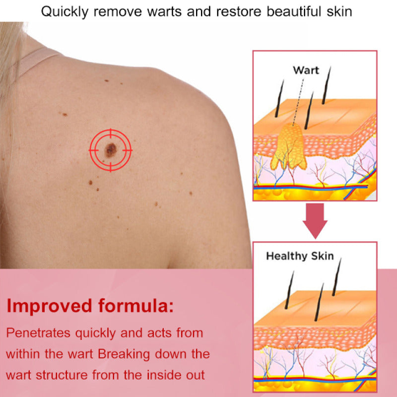 SwipeCart™ Goat's Milk Wart Removing Essential Oil Moisturizing Soap