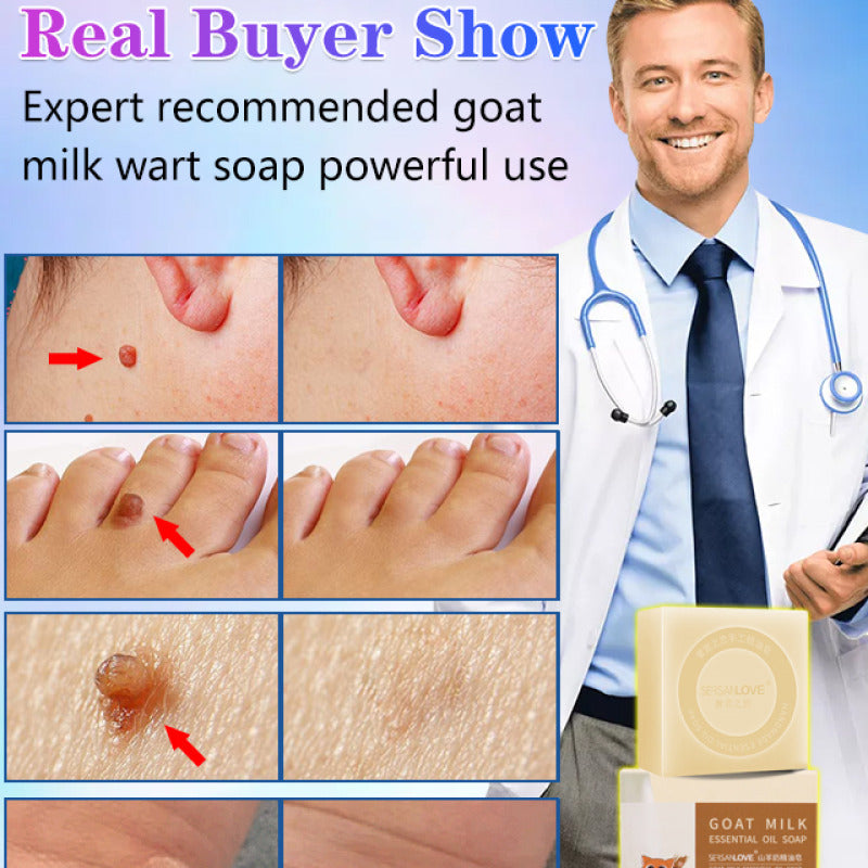 SwipeCart™ Goat's Milk Wart Removing Essential Oil Moisturizing Soap