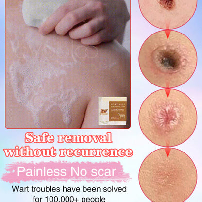 SwipeCart™ Goat's Milk Wart Removing Essential Oil Moisturizing Soap