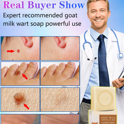 SwipeCart™ Goat's Milk Wart Removing Essential Oil Moisturizing Soap